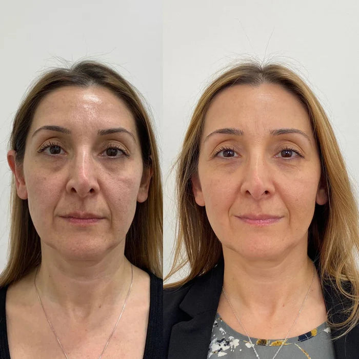 Baume Calcium Multi-Usage