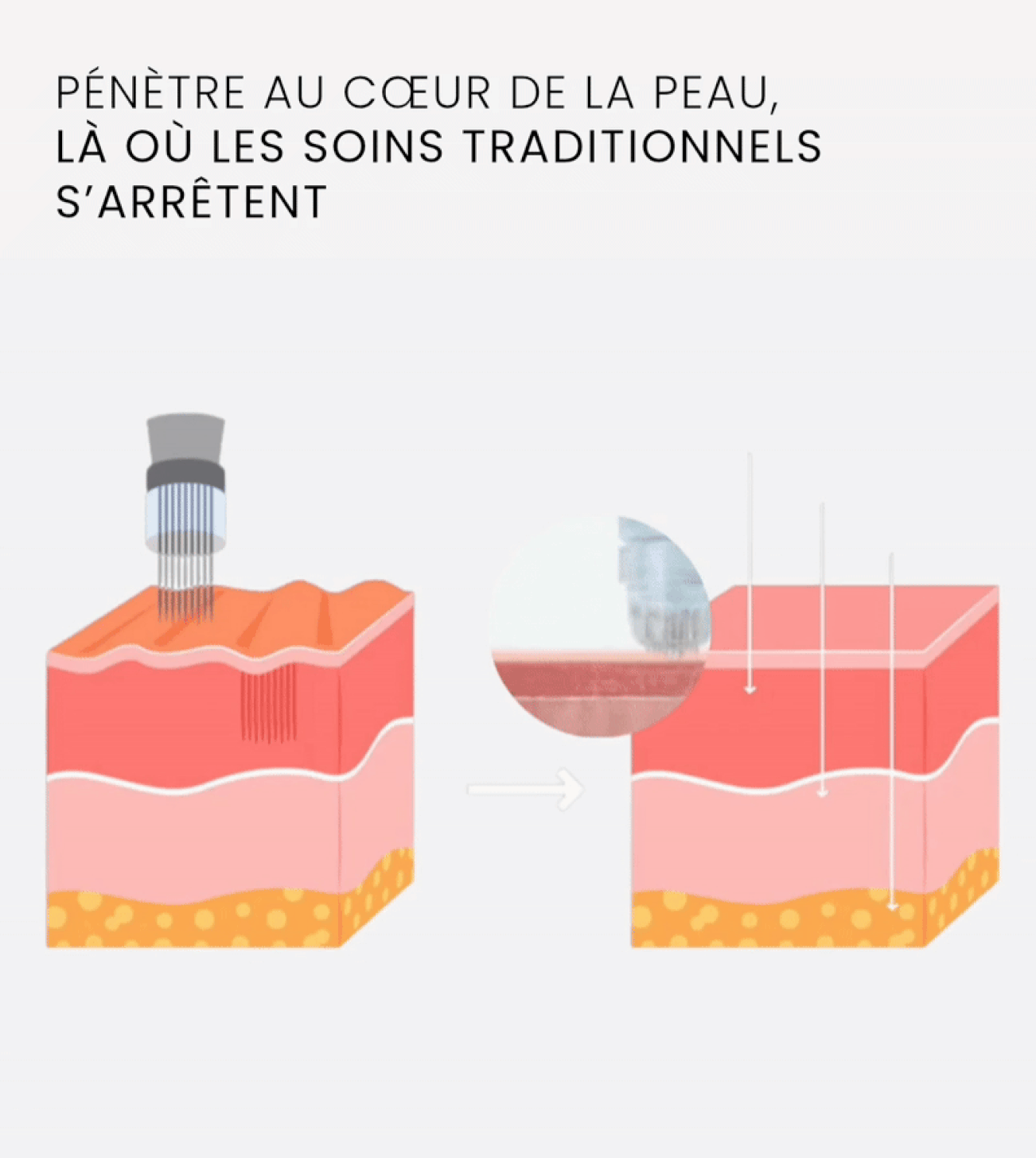 Élastilift+ | Le lifting sans institut, l'expertise en flacon